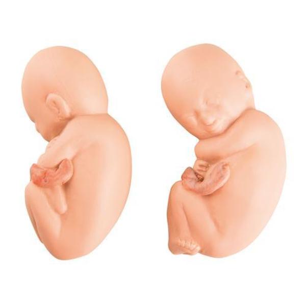 3B Scientific Anatomical Models, L10/7: Fetus 1020702